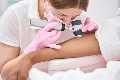 Close-up laser skin treatment